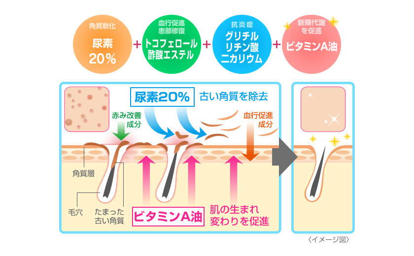 尿素20％＋トコフェロール＋グリチルリチン酸二カリウム＋ビタミンA油