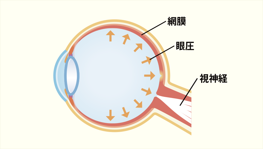 眼圧について