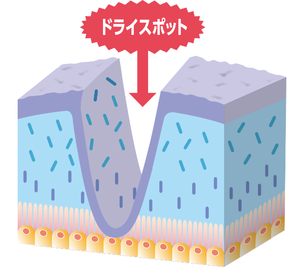 乾いてドライスポットができた涙液層